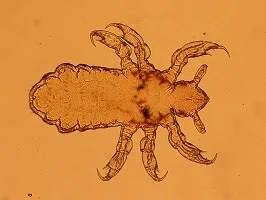 peluang usaha ternak kambing - cara ternak kambing - peternakan kambing - usaha ternak kambing